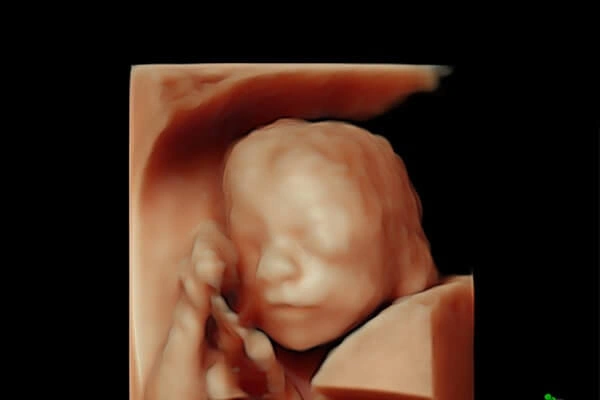 3erTrimestre Embarazo